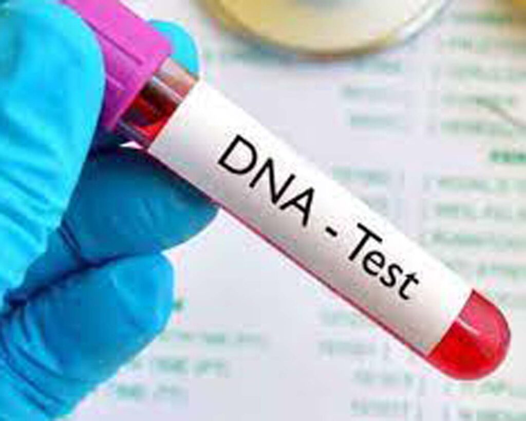 DNA Test : बच्चे के डीएनए टेस्ट से विवाद के हर साल 20 केस....जानिए पूरा मामला