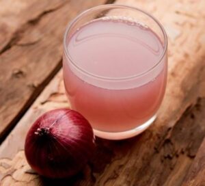 Read more about the article Onion juice सेहत, त्वचा और बालों के लिए लाभदायक है प्याज का रस