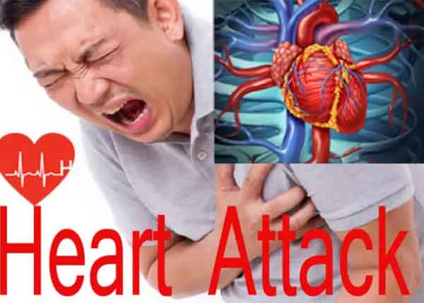 Heart Attack : व्यायाम से क्यों आ रहा है हार्ट अटैक? ये बना साइलेंट किलर, जानिए डॉक्टर से