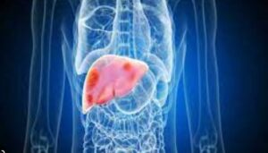 Read more about the article (Fatty liver) फैटी लीवर की बीमारी भारत में एक महामारी की तरह 