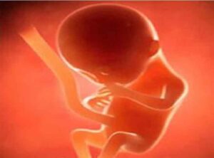 UP Souking News : मां के कोख से ही प्रेग्नेंट हो गया 5 माह का भ्रूण, रिपोर्ट देख डॉक्टर की सिट्टी-पिट्टी गुल