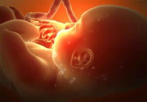 Successful brain surgery of unborn child : इतिहास मे पहली बार, गर्भ में पल रही बच्ची के ब्रेन की सफल सर्जरी…..2 दिन बाद पैदा हुई मासूम