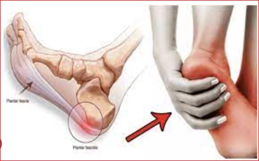 Pain in heel of foot