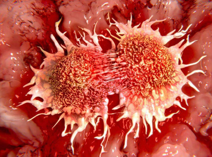 6 तरह के कैंसर, इस खतरनाक वायरस से बढ़ते हैं...शरीर के ये अंग देते हैं संकेत