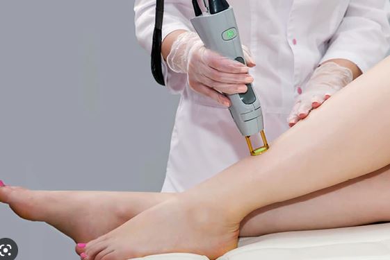 (laser hair removal treatment)
